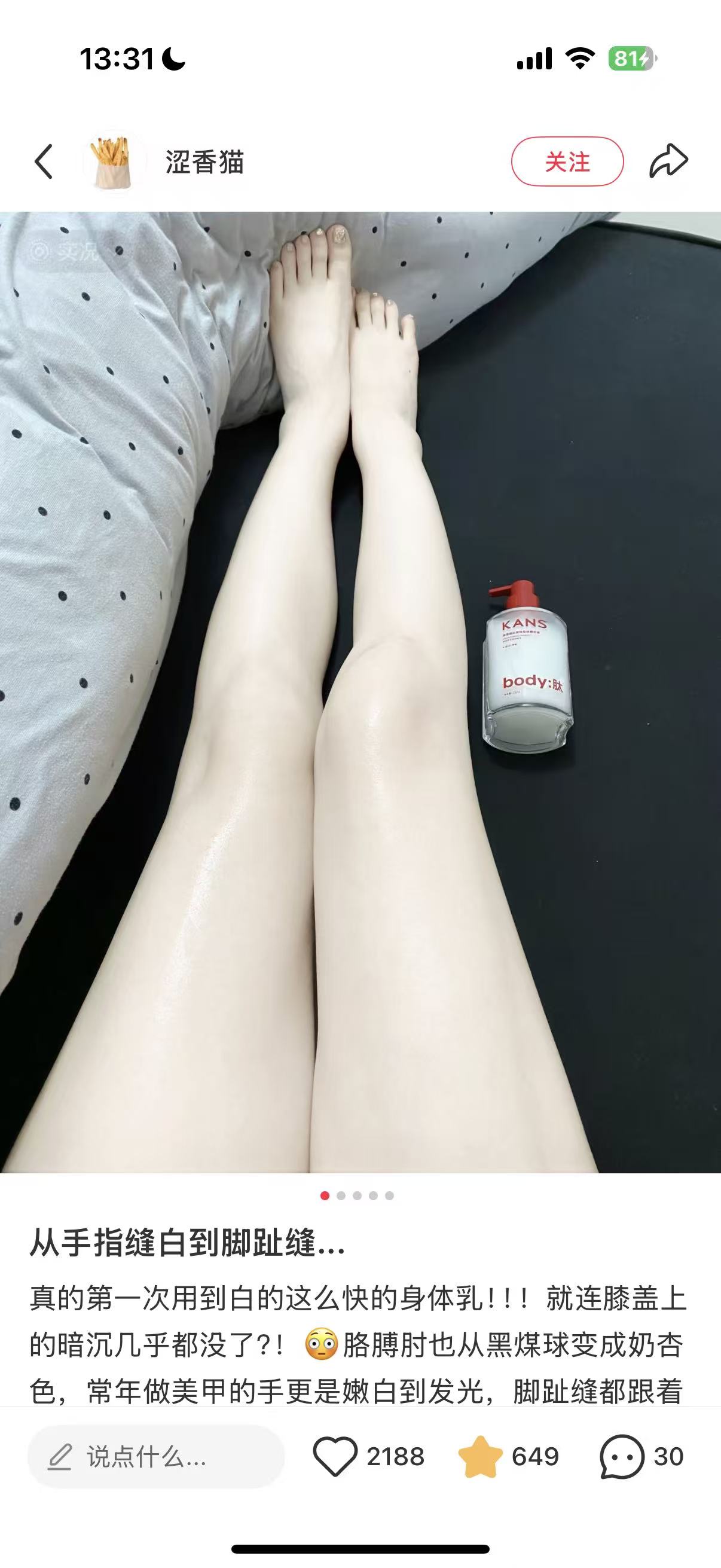 从手指缝白到脚趾缝小红书笔记截图